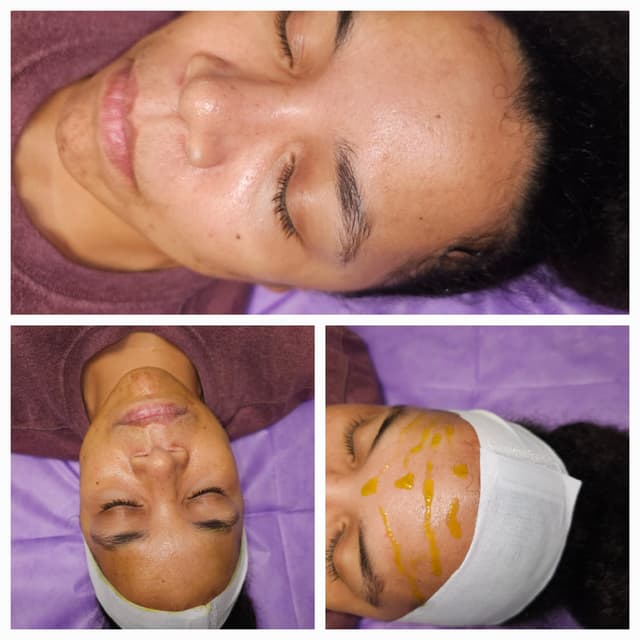 BioRePeelCl3 – 4 Face Package